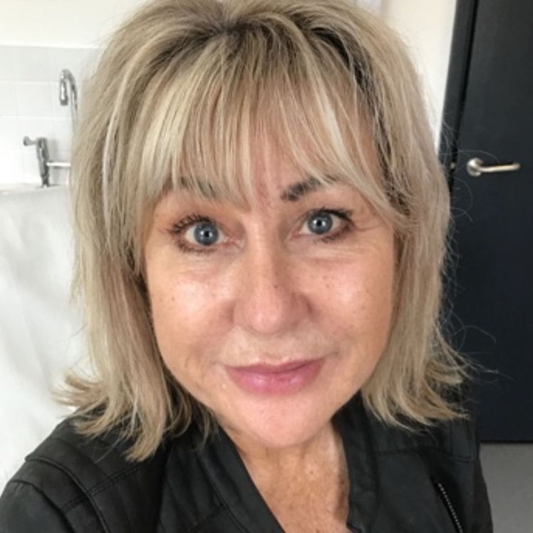 Sharon after dermatica anti-ageing treatment
