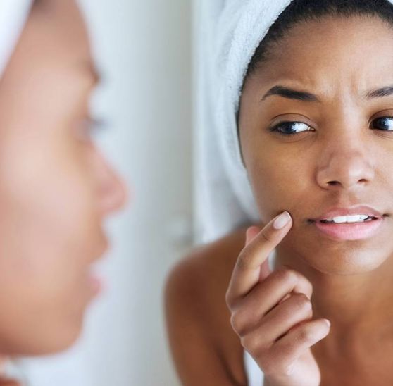 Black woman looking at her face skin in the mirror