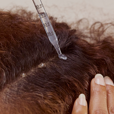 Close up of person applying hair loss serum