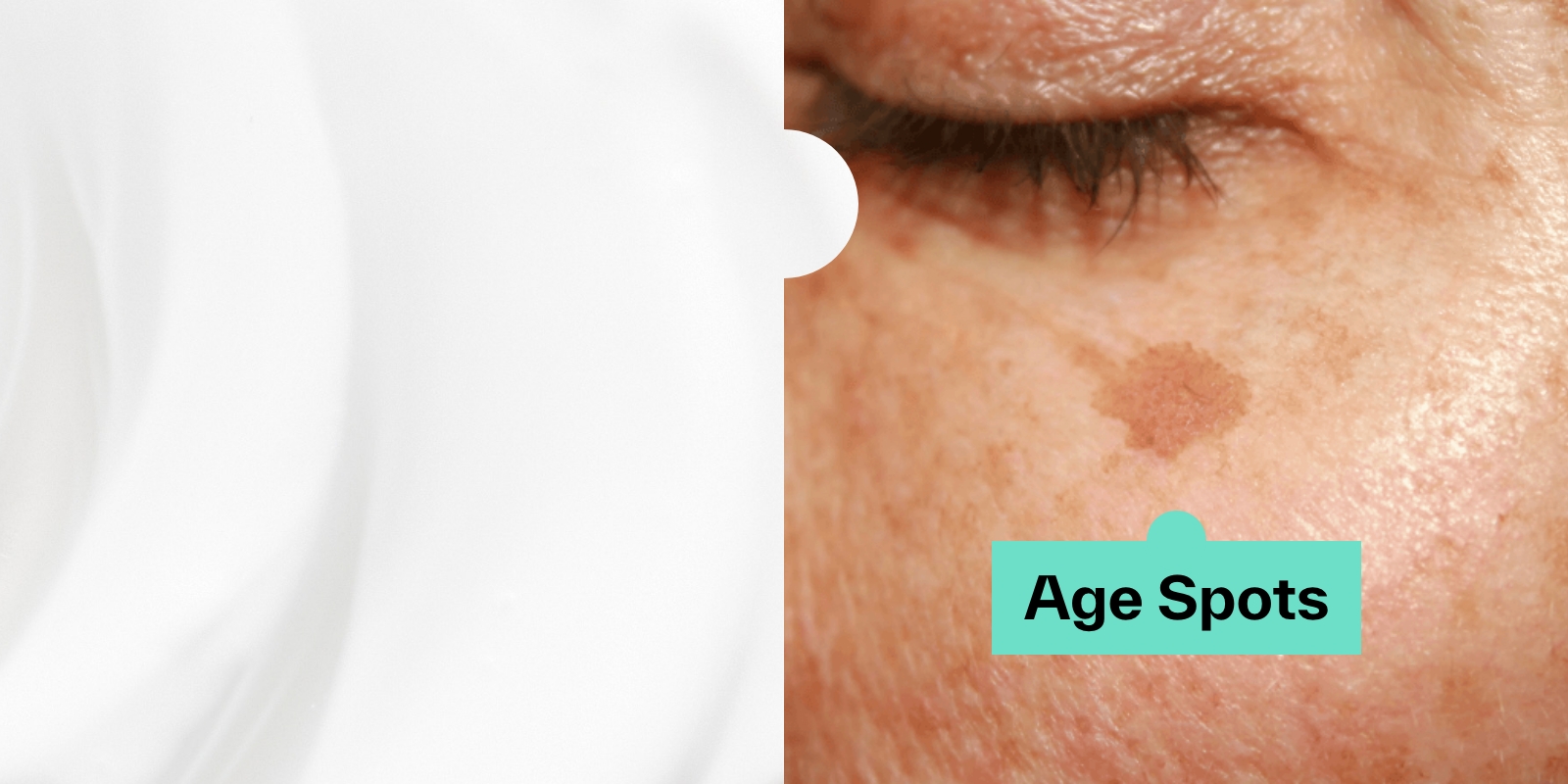 How to remove age spots naturally